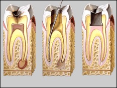 ENDODONCIA 1